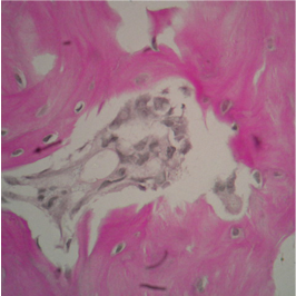 ГИПОЭСТРОГЕННАЯ МОДЕЛЬ ОСТЕОПОРОЗА ДВУСТОРОННЯЯ ОВАРИОЭКТОМИЯ 2,5 МЕСЯЦА